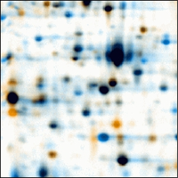 Dual View Warped Dual View Warped